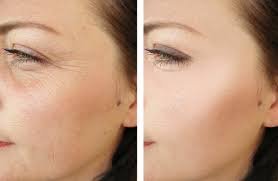 Anti-Aging Skincare