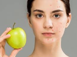 Diet & Skin Health